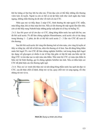 123
khí hư loãng có bọt hay khí hư như mủ. Ở âm đạo còn có thể thấy những tổn thương
viêm loét, lộ tuyến. Ngoài ra còn có thể có dị tật bẩm sinh như vách ngăn dọc hoặc
ngang, những chấn thương do đẻ như vết rách cũ của CTC.
Nhìn qua mỏ vịt thấy được 2 mép CTC, bình thường thì mặt ngoài CTC nhẵn,
màu hồng nhạt, khi có thai màu hơi tím. Nếu có tổn thương thì mặt ngoài lấm tấm nhỏ,
còn có thể thấy nang Naboth hoặc những polip xuất phát từ cổ hay từ buồng TC.
2.4.3. Sau khi quan sát kỹ âm đạo và CTC, dùng bông thấm nước lau sạch khí hư, sau
đó bôi acid acetic 3% để làm chứng nghiệm Hinsenlmann, acid acetic chỉ có tác dụng
trong khoảng 1 - 2 phút, do đó có thể bôi acid acetic 2 - 3 lần vào CTC để xem rõ
tổn thương.
Sau khi bôi acid acetic thì vùng tổn thương loét sẽ rớm máu, còn vùng lộ tuyến sẽ
thấy se trắng lại, chế tiết sẽ kết tủa, nhìn tổn thương sẽ rõ hơn. Sau đó dùng bông thấm
nước bôi lugol 3% vào CTC để làm chứng nghiệm Schiller, iod trong dung dịch lugol
tác dụng với glycogen có nhiều ở các tế bào lớp giữa và lớp bề mặt của biểu mô lát
tầng CTC và âm đạo tạo ra một màu nâu thẫm. Nếu toàn bộ CTC có màu nâu thẫm là
biểu mô lát bình thường, gọi là chứng nghiệm Schiller âm tính. Nếu có điều kiện soi
CTC để phát hiện các tổn thương nghi ngờ.
2.4.4. Tháo mỏ vịt: trước khi tháo mỏ vịt nên dùng bông thấm nước lau sạch âm đạo và
CTC, sau đó tháo chốt cố định, khép mỏ vịt lại, quay chốt mỏ vịt sang ngang, rồi nhẹ
nhàng rút mỏ vịt ra.
Hình 24. Dụng cụ khám phụ khoa
 