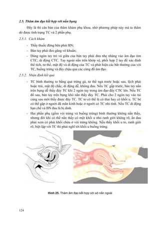 124
2.5. Thăm âm đạo kết hợp với nắn bụng
Đây là thì căn bản của thăm khám phụ khoa, nhờ phương pháp này mà ta thăm
dò được tình trạng TC và 2 phần phụ.
2.5.1. Cách khám
- Thầy thuốc đứng bên phải BN;
- Bàn tay phải đeo găng vô khuẩn;
- Dùng ngón tay trỏ và giữa của bàn tay phải đưa nhẹ nhàng vào âm đạo tìm
CTC, di động CTC. Tay ngoài nắn trên khớp vệ, phối hợp 2 tay để xác định
thể tích, tư thế, mật độ và di động của TC và phát hiện các bất thường của vòi
TC, buồng trứng và đáy chậu qua các cùng đồ âm đạo.
2.5.2. Nhận định kết quả
- TC bình thường to bằng quả trứng gà, tư thế ngả trước hoặc sau, lệch phải
hoặc trái, mật độ chắc, di động dễ, không đau. Nếu TC gấp trước, bàn tay nắn
trên bụng dễ thấy đáy TC khi 2 ngón tay trong âm đạo đẩy CTC lên. Nếu TC
đổ sau, bàn tay trên bụng khó nắn thấy đáy TC. Phải cho 2 ngón tay vào túi
cùng sau mới thấy được đáy TC. TC to có thể là có thai hay có khối u. TC bé
có thể gặp ở người đã mãn kinh hoặc ở người có TC nhi tính. Nếu TC di động
hạn chế và BN đau là bị dính.
- Hai phần phụ (gồm vòi trứng và buồng trứng) bình thường không nắn thấy,
nhưng đôi khi có thể nắn thấy có một khối u nhỏ ranh giới không rõ, ấn đau
phải xem có phải khối chứa ở vòi trứng không. Nếu thấy khối u to, ranh giới
rõ, biệt lập với TC thì phải nghĩ tới khối u buồng trứng.
Hình 25. Thăm âm đạo kết hợp với sờ nắn ngoài
 