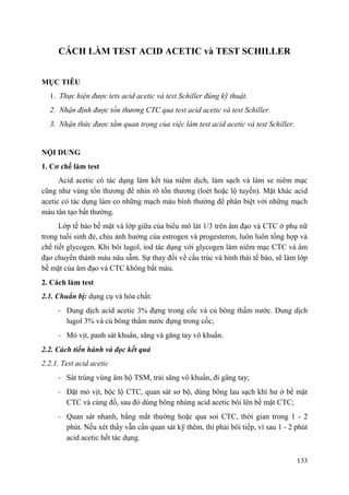 133
CÁCH LÀM TEST ACID ACETIC và TEST SCHILLER
MỤC TIÊU
1. Thực hiện được tets acid acetic và test Schiller đúng kỹ thuật.
2. Nhận định được tổn thương CTC qua test acid acetic và test Schiller.
3. Nhận thức được tầm quan trọng của việc làm test acid acetic và test Schiller.
NỘI DUNG
1. Cơ chế làm test
Acid acetic có tác dụng làm kết tủa niêm dịch, làm sạch và làm se niêm mạc
cũng như vùng tổn thương để nhìn rõ tổn thương (loét hoặc lộ tuyến). Mặt khác acid
acetic có tác dụng làm co những mạch máu bình thường để phân biệt với những mạch
máu tân tạo bất thường.
Lớp tế bào bề mặt và lớp giữa của biểu mô lát 1/3 trên âm đạo và CTC ở phụ nữ
trong tuổi sinh đẻ, chịu ảnh hưởng của estrogen và progesteron, luôn luôn tổng hợp và
chế tiết glycogen. Khi bôi lugol, iod tác dụng với glycogen làm niêm mạc CTC và âm
đạo chuyển thành màu nâu sẫm. Sự thay đổi về cấu trúc và hình thái tế bào, sẽ làm lớp
bề mặt của âm đạo và CTC không bắt màu.
2. Cách làm test
2.1. Chuẩn bị: dụng cụ và hóa chất:
- Dung dịch acid acetic 3% đựng trong cốc và củ bông thấm nước. Dung dịch
lugol 3% và củ bông thấm nước đựng trong cốc;
- Mỏ vịt, panh sát khuẩn, săng và găng tay vô khuẩn.
2.2. Cách tiến hành và đọc kết quả
2.2.1. Test acid acetic
- Sát trùng vùng âm hộ TSM, trải săng vô khuẩn, đi găng tay;
- Đặt mỏ vịt, bộc lộ CTC, quan sát sơ bộ, dùng bông lau sạch khí hư ở bề mặt
CTC và cùng đồ, sau đó dùng bông nhúng acid acetic bôi lên bề mặt CTC;
- Quan sát nhanh, bằng mắt thường hoặc qua soi CTC, thời gian trong 1 - 2
phút. Nếu xét thấy vẫn cần quan sát kỹ thêm, thì phải bôi tiếp, vì sau 1 - 2 phút
acid acetic hết tác dụng.
 