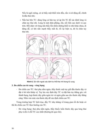 50
Nếu là ngôi mông, sờ sẽ thấy một khối tròn đều, rắn và di động dễ, chính
là đầu thai nhi;
Nắn hai bên TC: dùng lòng cả bàn tay sờ áp lên TC để xác định lưng và
chân tay thai nhi. Lưng là một diện phẳng, rắn, nối liền cực dưới và cực
trên. Đối diện với lưng nắn thấy lổn nhổn những khối to nhỏ khác nhau, di
động dễ, có khi nắn mạnh thấy mất đi, rồi lại hiện ra, đó là chân tay
thai nhi.
Hình 6. Sờ nắn ngoài xác định tư thế thai nhi trong tử cung
3. Đo chiều cao tử cung - vòng bụng
- Đo chiều cao TC: thai phụ nằm ngửa, thầy thuốc một tay giữ đầu thước dây và
đặt ở bờ trên khớp vệ. Tay kia xác định đáy TC và đặt bàn tay thẳng góc với
thành bụng, kẹp thước dây giữa ngón trỏ và ngón giữa sao cho thước dây thẳng
căng. Nhìn vào mức của thước dây để xác định chiều cao TC.
Trong trường hợp TC lệch trục, đẩy TC nhẹ nhàng về trung gian rồi đo hoặc có
thể đo chiều cao TC theo hướng của TC.
- Đo vòng bụng: thai phụ nằm ngửa, thầy thuốc luồn thước dây qua lưng thai
phụ và đo ở chỗ TC cao nhất (thường đo qua rốn).
 
