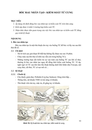 93
BÓC RAU NHÂN TẠO - KIỂM SOÁT TỬ CUNG
MỤC TIÊU
1. Áp dụng chỉ định đúng bóc rau nhân tạo và kiểm soát TC trên lâm sàng.
2. Kiến tập được ít nhất 3 trường hợp kiểm soát TC.
3. Nhận thức được tầm quan trọng của việc bóc rau nhân tạo và kiểm soát TC đúng
quy trình kỹ thuật.
NỘI DUNG
1. Bóc rau nhân tạo
Bóc rau nhân tạo là một thủ thuật cho tay vào buồng TC để bóc và lấy rau sau khi
thai đã sổ.
1.1. Chỉ định
- Xử trí tích cực giai đoạn III thất bại không lấy được rau sau 10 phút;
- Chảy máu sau khi thai sổ (khi rau vẫn còn trong buồng TC);
- Những trường hợp cần kiểm tra sự vẹn toàn của buồng TC sau khi sổ thai,
thường là bóc rau nhân tạo ngay để đồng thời kiểm soát buồng TC. Ví dụ:
nghi ngờ vỡ TC sau khi làm thủ thuật đường dưới khó khăn như Forceps, nội
xoay thai, cắt thai, TC có sẹo mổ cũ…
1.2. Kỹ thuật
1.2.1. Chuẩn bị
- Cho thuốc giảm đau: Pethidin 0,1g hay Seduxen 10mg tiêm bắp…
- Thông tiểu, sát khuẩn TSM và trải săng vô khuẩn;
- Thủ thuật viên rửa tay, mặc áo, đi găng tay vô khuẩn.
Hình 19. Kỹ thuật bóc rau nhân tạo, kiểm soát tử cung
 