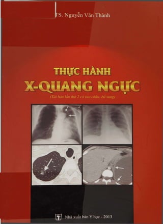 ipiCNJ
008239 S. Nguyen Van Thanh
T H I T C H A N H
X-QUANG NGITC
(Tcti han Ian thir 2 co sira chua, ho sung)
Nha xuat ban Y hoc - 2013
 