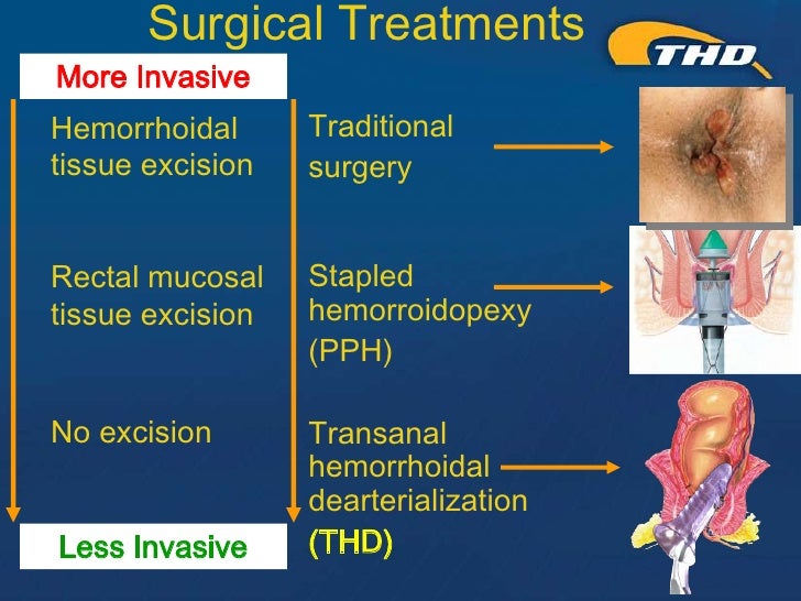 THD Procedure for Hemorrhoids A Kinder, Gentler Approach Presented…