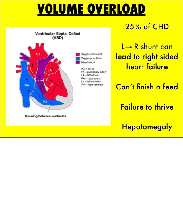 The Crashing Cardiac Baby