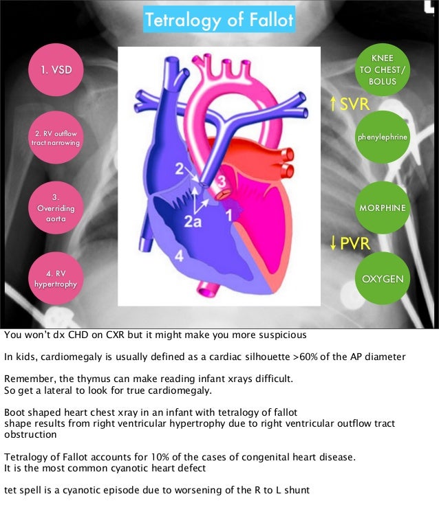 The Crashing Cardiac Baby