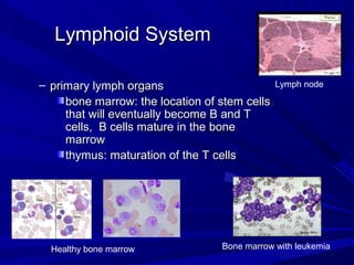Lymphoid SystemLymphoid System
– primary lymph organsprimary lymph organs
bone marrow: the location of stem cellsbone marrow: the location of stem cells
that will eventually become B and Tthat will eventually become B and T
cells, B cells mature in the bonecells, B cells mature in the bone
marrowmarrow
thymus: maturation of the T cellsthymus: maturation of the T cells
Healthy bone marrow Bone marrow with leukemia
Lymph node
 