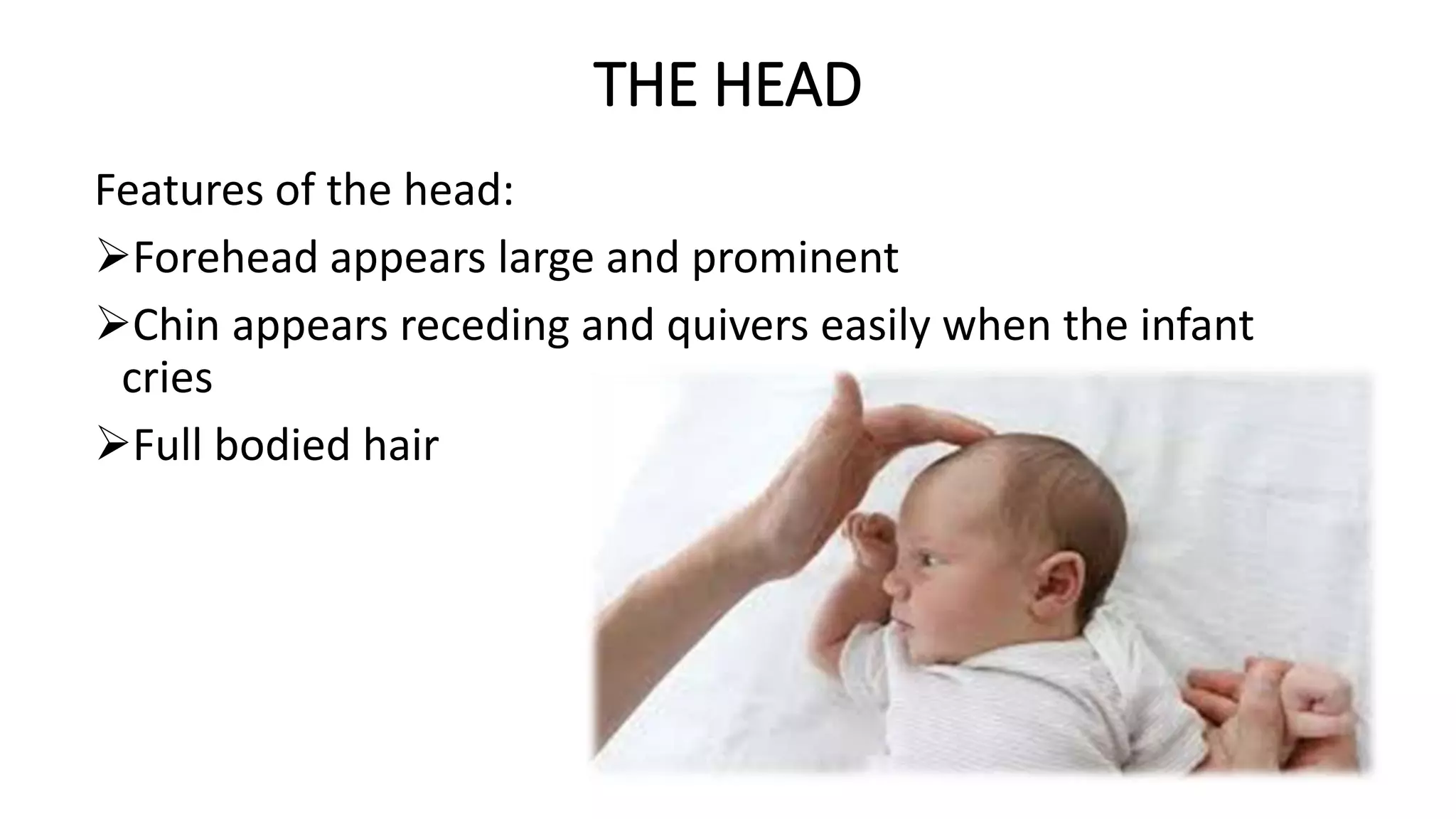 THE-APPEARANCE-OF-A-NEWBORN-ppt_(1).pptx