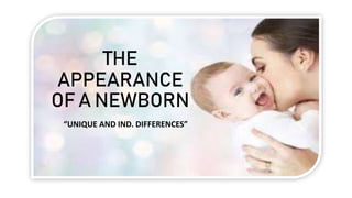 THE
APPEARANCE
OF A NEWBORN
“UNIQUE AND IND. DIFFERENCES”
 