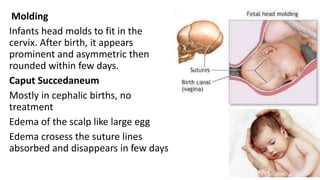 Positional Molding THE-APPEARANCE-OF-A-NEWBORN-ppt_(1).pptx