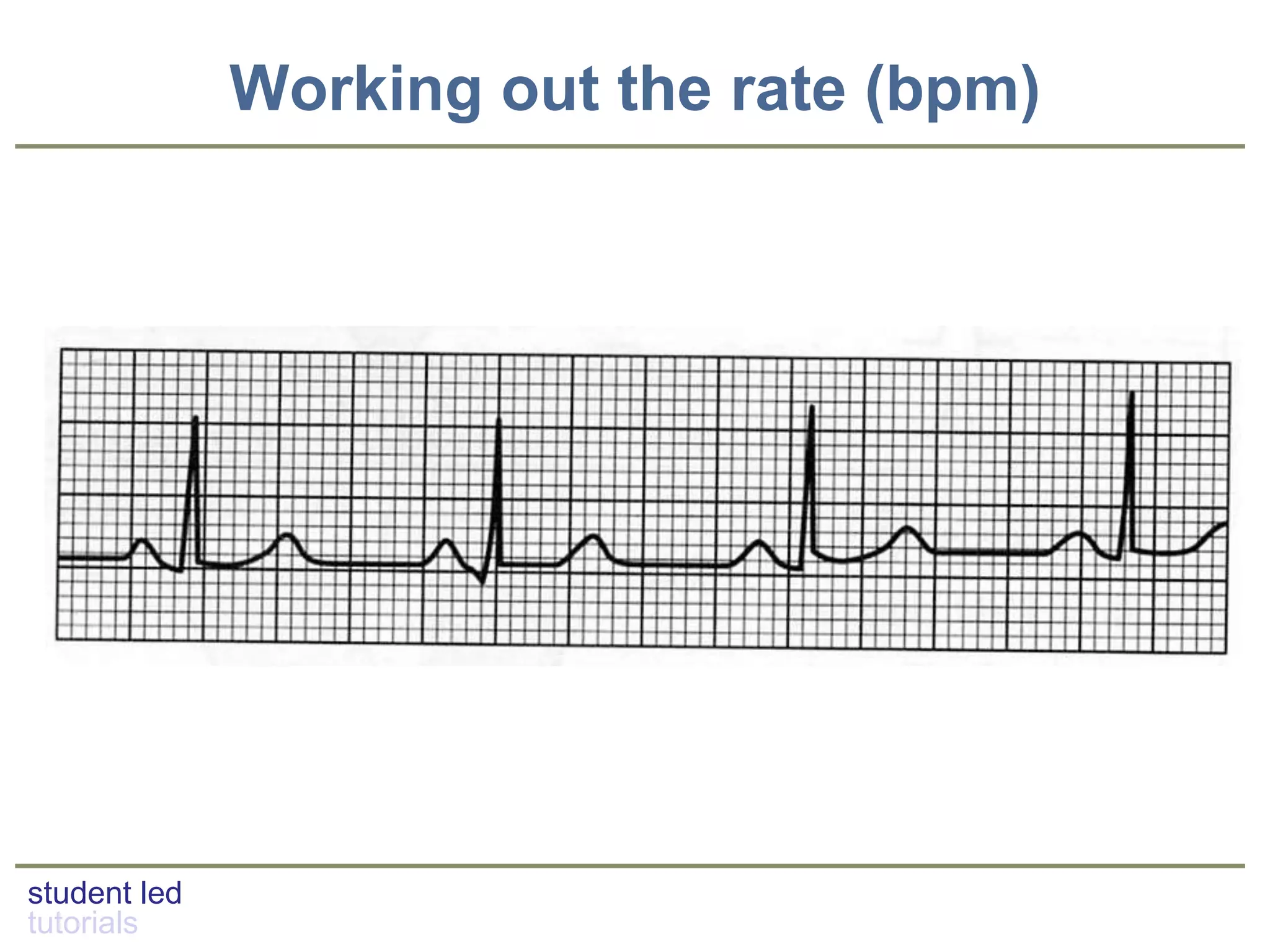 student led
tutorials
Working out the rate (bpm)
 