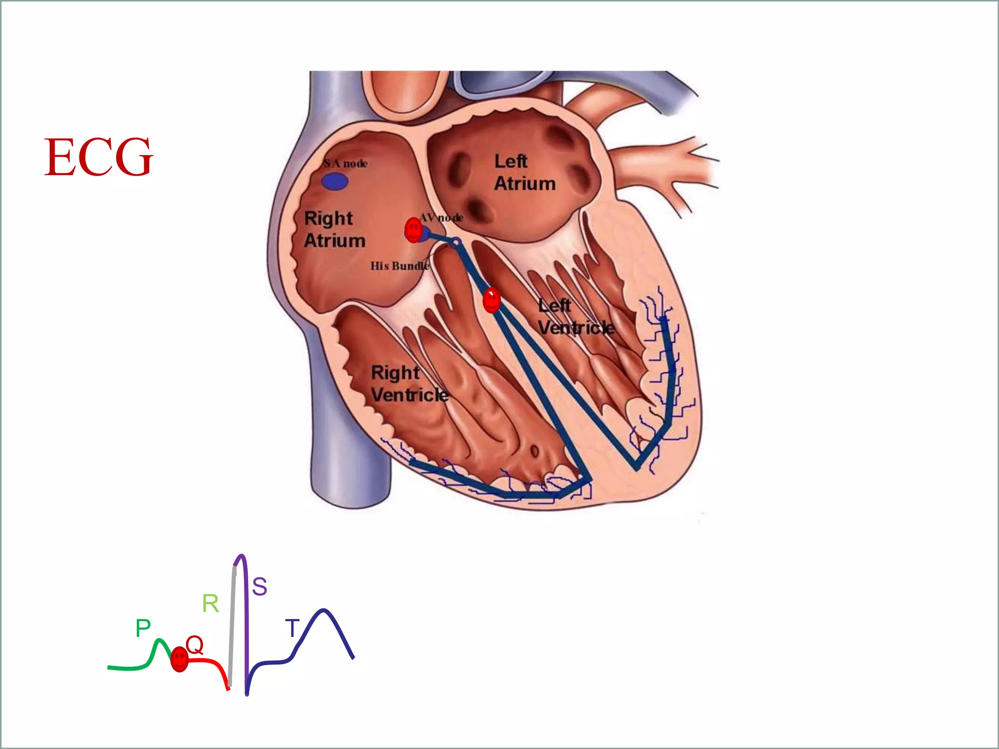 student led
tutorials
`
P
Q
R
S
T
ECG
 