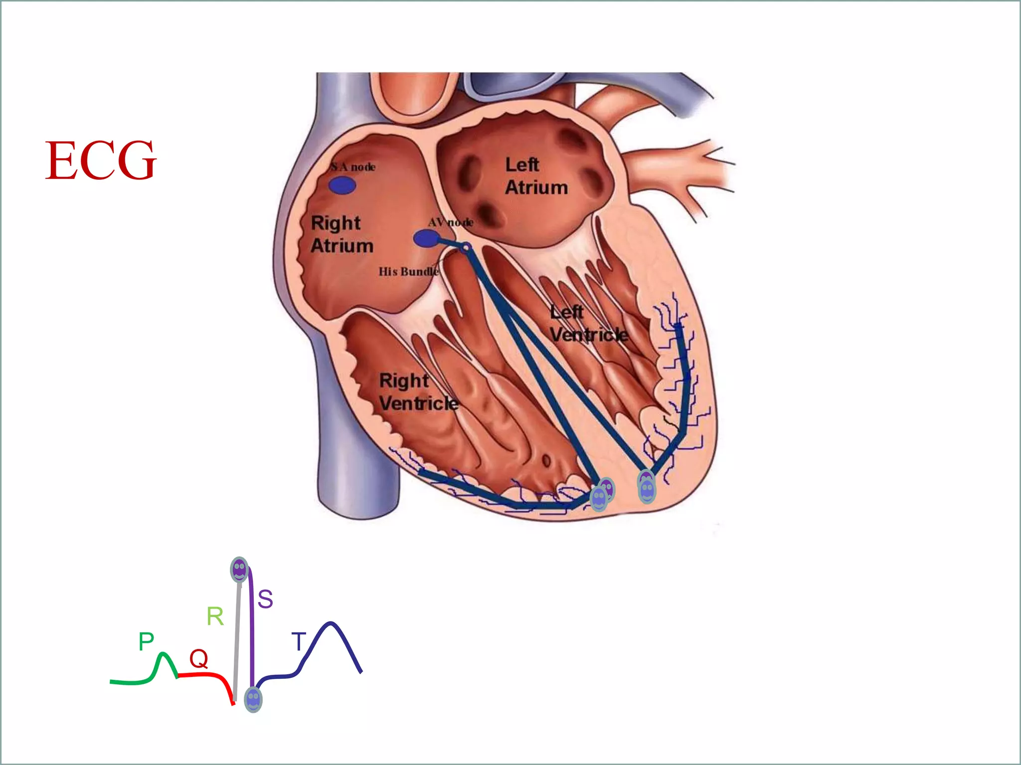 student led
tutorials
P
Q
R
S
T
ECG
 