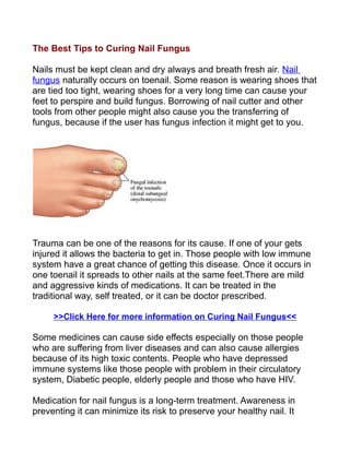 The Best Tips to Curing Nail Fungus

Nails must be kept clean and dry always and breath fresh air. Nail
fungus naturally occurs on toenail. Some reason is wearing shoes that
are tied too tight, wearing shoes for a very long time can cause your
feet to perspire and build fungus. Borrowing of nail cutter and other
tools from other people might also cause you the transferring of
fungus, because if the user has fungus infection it might get to you.




Trauma can be one of the reasons for its cause. If one of your gets
injured it allows the bacteria to get in. Those people with low immune
system have a great chance of getting this disease. Once it occurs in
one toenail it spreads to other nails at the same feet.There are mild
and aggressive kinds of medications. It can be treated in the
traditional way, self treated, or it can be doctor prescribed.

     >>Click Here for more information on Curing Nail Fungus<<

Some medicines can cause side effects especially on those people
who are suffering from liver diseases and can also cause allergies
because of its high toxic contents. People who have depressed
immune systems like those people with problem in their circulatory
system, Diabetic people, elderly people and those who have HIV.

Medication for nail fungus is a long-term treatment. Awareness in
preventing it can minimize its risk to preserve your healthy nail. It
 