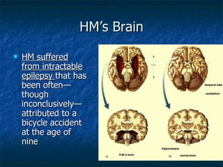 HM’s Brain HM suffered from intractable epilepsy  that has been often—though inconclusively—attributed to a bicycle accident at the age of nine  