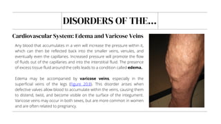 DISORDERS OF THE...
Any blood that accumulates in a vein will increase the pressure within it,
which can then be reflected back into the smaller veins, venules, and
eventually even the capillaries. Increased pressure will promote the flow
of fluids out of the capillaries and into the interstitial fluid. The presence
of excess tissue fluid around the cells leads to a condition called edema.
Edema may be accompanied by varicose veins, especially in the
superficial veins of the legs (Figure 20.8). This disorder arises when
defective valves allow blood to accumulate within the veins, causing them
to distend, twist, and become visible on the surface of the integument.
Varicose veins may occur in both sexes, but are more common in women
and are often related to pregnancy.
Cardiovascular System: Edema and Varicose Veins
 