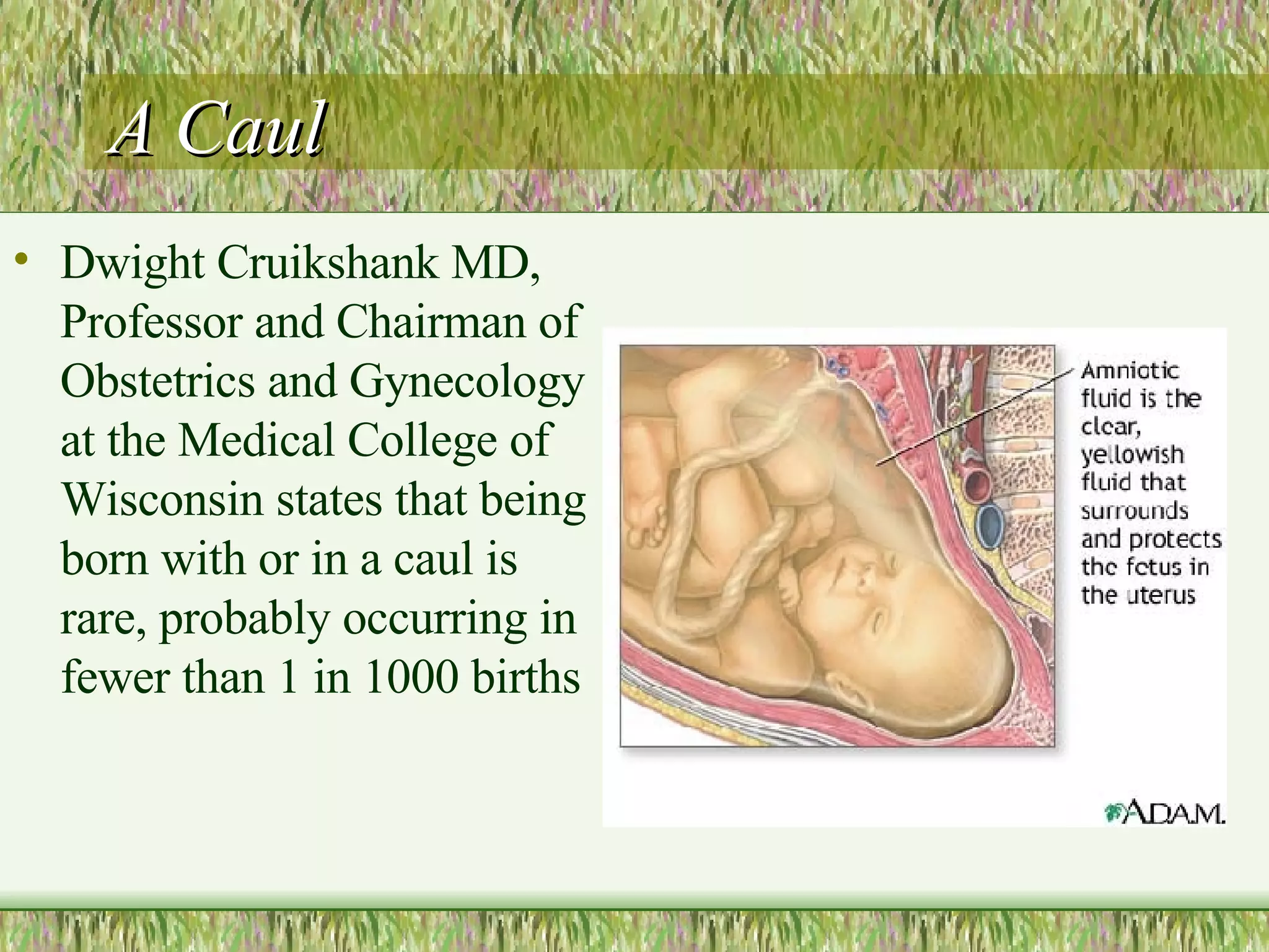 A Caul Dwight Cruikshank MD, Professor and Chairman of Obstetrics and Gynecology at the Medical College of Wisconsin states that being born with or in a caul is rare, probably occurring in fewer than 1 in 1000 births 
