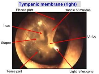 Light reflex cone Tympanic membrane (right) Handle of malleus Incus Stapes Umbo Flaccid part Tense part 