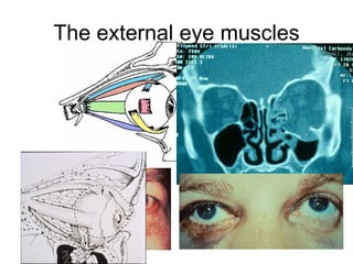 The external eye muscles 