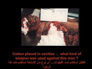 Cotton placed in cavities … what kind of weapon was used against this man ? القطن استُخدِم لسد الفجوات ...  أي نوع من الأسلحة استُخدِم ضد هذا الرجل؟ 