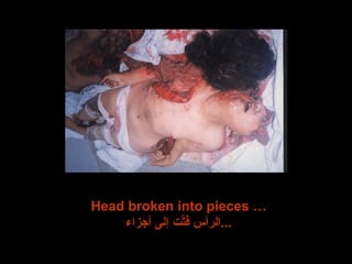 Head broken into pieces … الرأس فُتِّت إلى أجزاء ... 