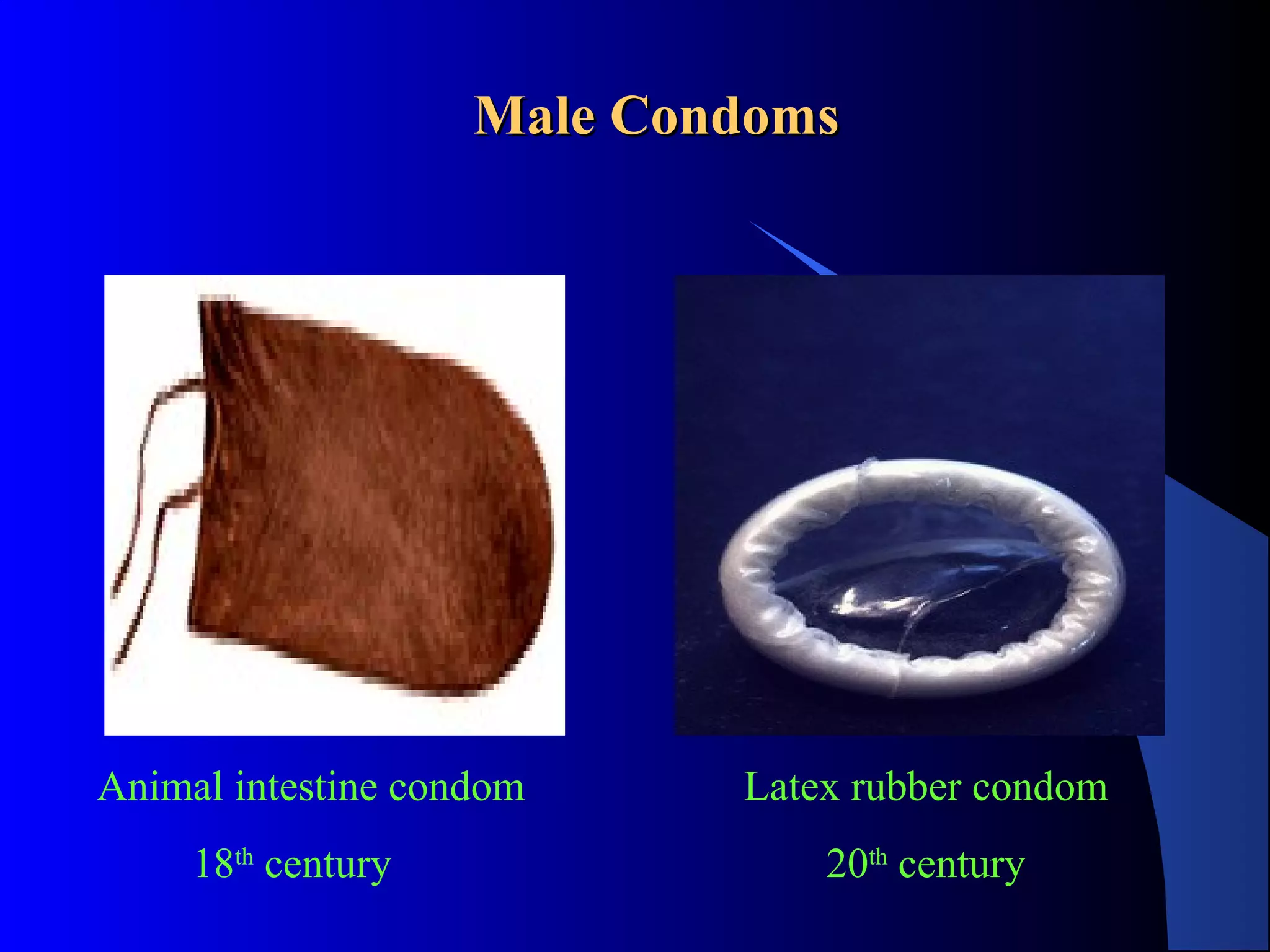 The female condom | PPT