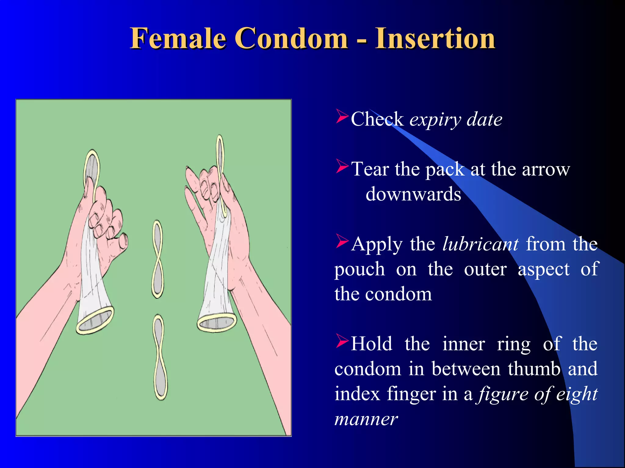 The Female Condom PPT The Female Condom PPT