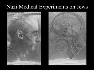 Nazi Medical Experiments on Jews   