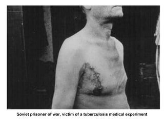 Soviet prisoner of war, victim of a tuberculosis medical experiment 