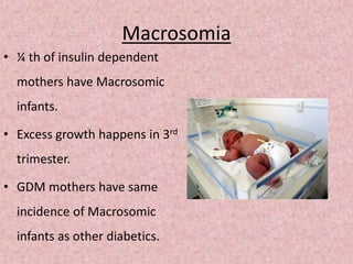 Macrosomia
• ¼ th of insulin dependent
mothers have Macrosomic
infants.
• Excess growth happens in 3rd
trimester.
• GDM mothers have same
incidence of Macrosomic
infants as other diabetics.
 