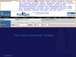 Top Frame on Browser Window 