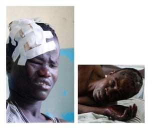 The price-of-tribal-politics