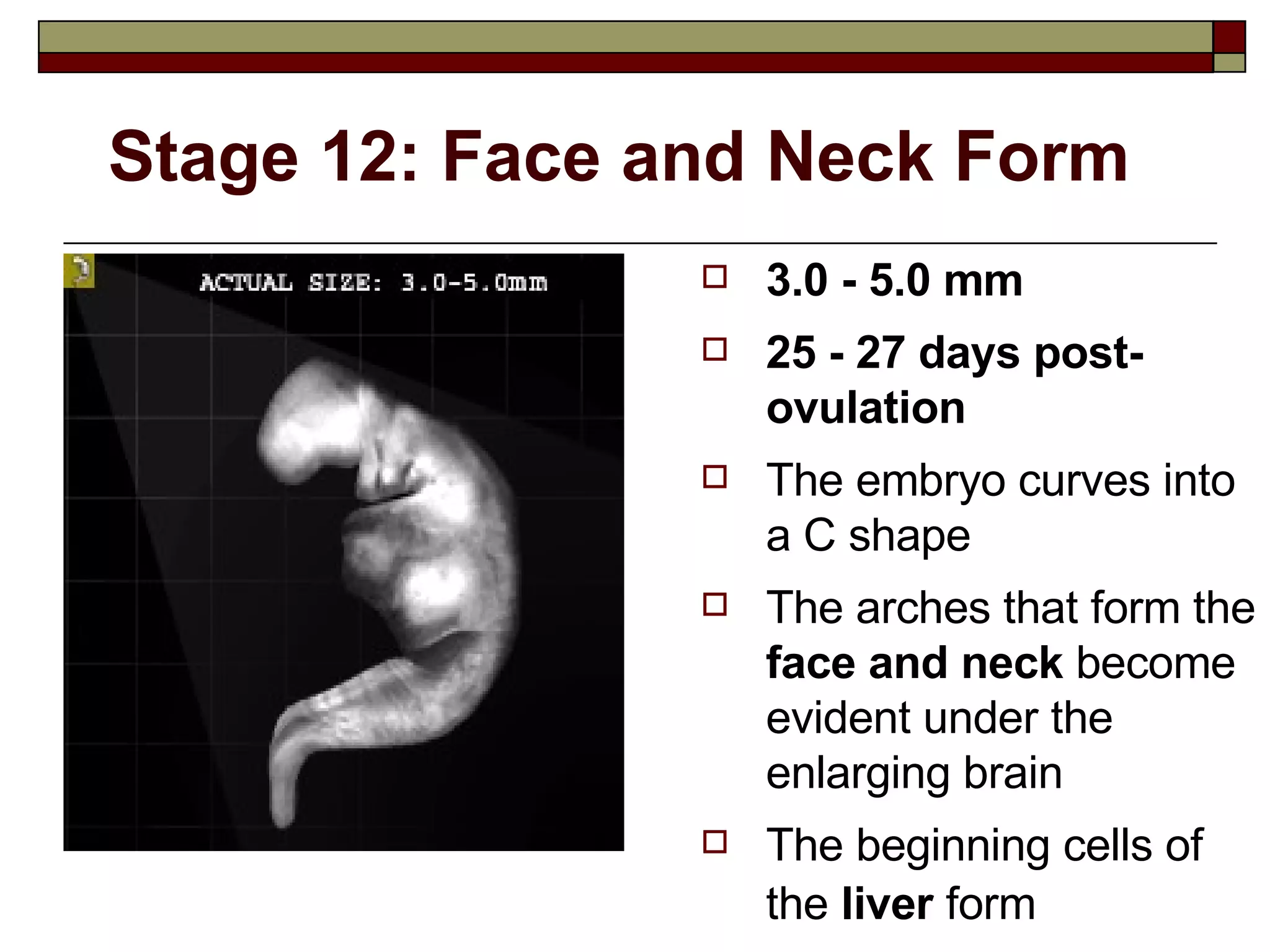 Stage 12: Face and Neck Form 3.0 - 5.0 mm 25 - 27 days post-ovulation The embryo curves into a C shape The arches that form the  face and neck  become evident under the enlarging brain The beginning cells of the  liver  form   