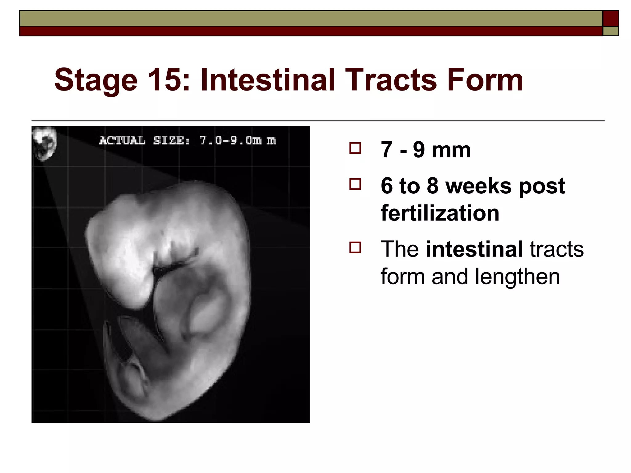 Stage 15: Intestinal Tracts Form 7 - 9 mm 6 to 8 weeks post fertilization The  intestinal  tracts form and lengthen 