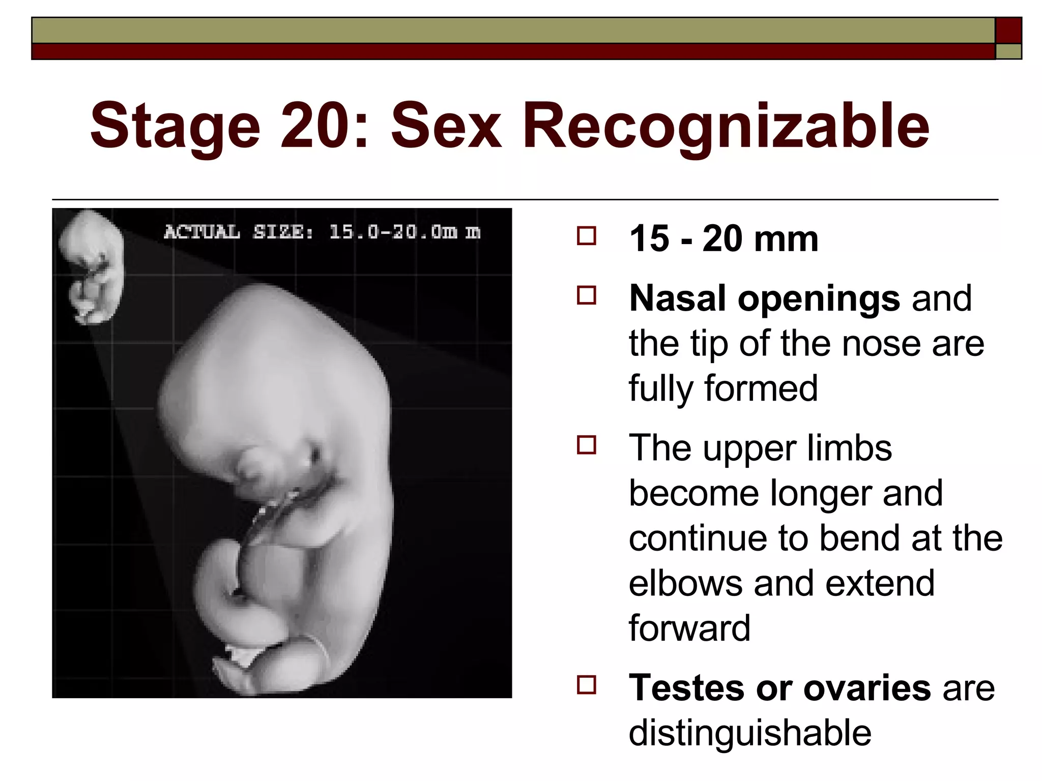 Stage 20: Sex Recognizable 15 - 20 mm Nasal openings  and the tip of the nose are fully formed The upper limbs become longer and continue to bend at the elbows and extend forward  Testes or ovaries  are distinguishable 