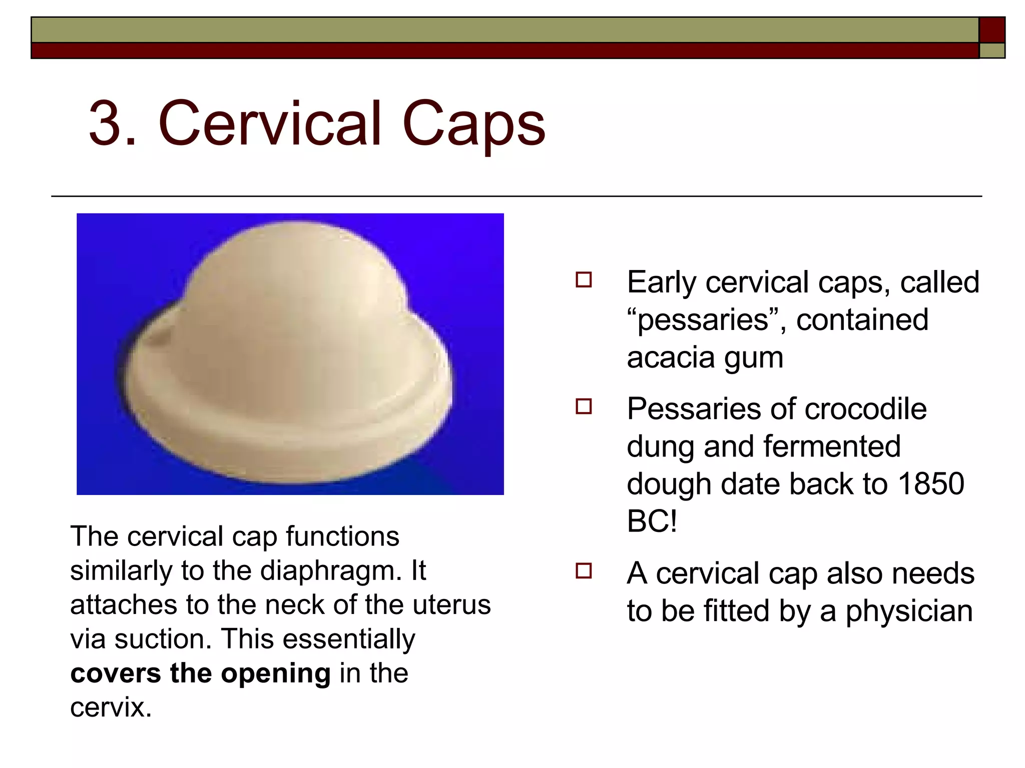 3. Cervical Caps Early cervical caps, called “pessaries”, contained acacia gum Pessaries of crocodile dung and fermented dough date back to 1850 BC! A cervical cap also needs to be fitted by a physician The cervical cap functions similarly to the diaphragm. It attaches to the neck of the uterus via suction. This essentially  covers the opening  in the cervix. 