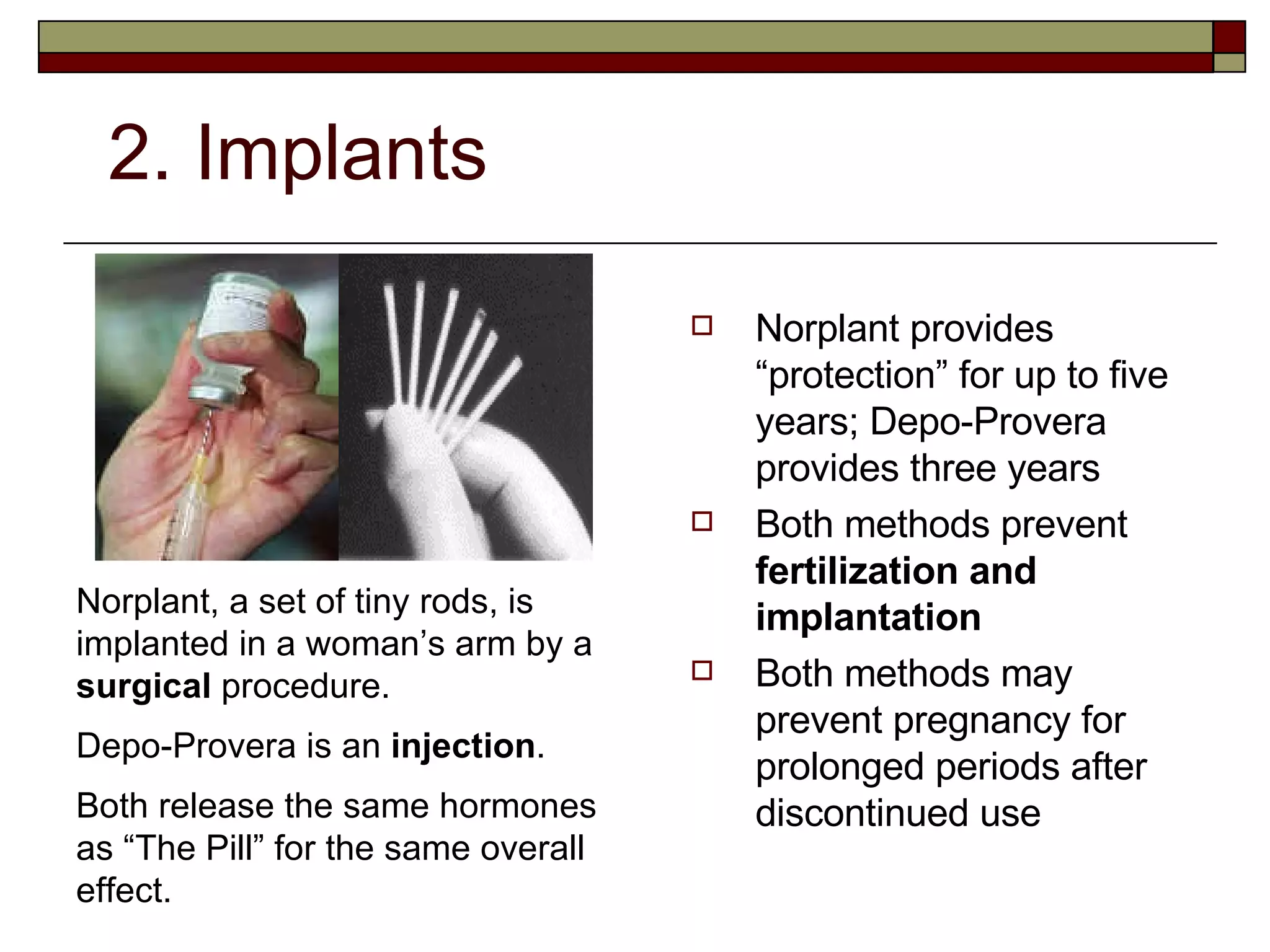 2. Implants Norplant provides “protection” for up to five years; Depo-Provera provides three years Both methods prevent  fertilization and implantation Both methods may prevent pregnancy for prolonged periods after discontinued use Norplant, a set of tiny rods, is implanted in a woman’s arm by a  surgical  procedure.  Depo-Provera is an  injection . Both release the same hormones as “The Pill” for the same overall effect. 