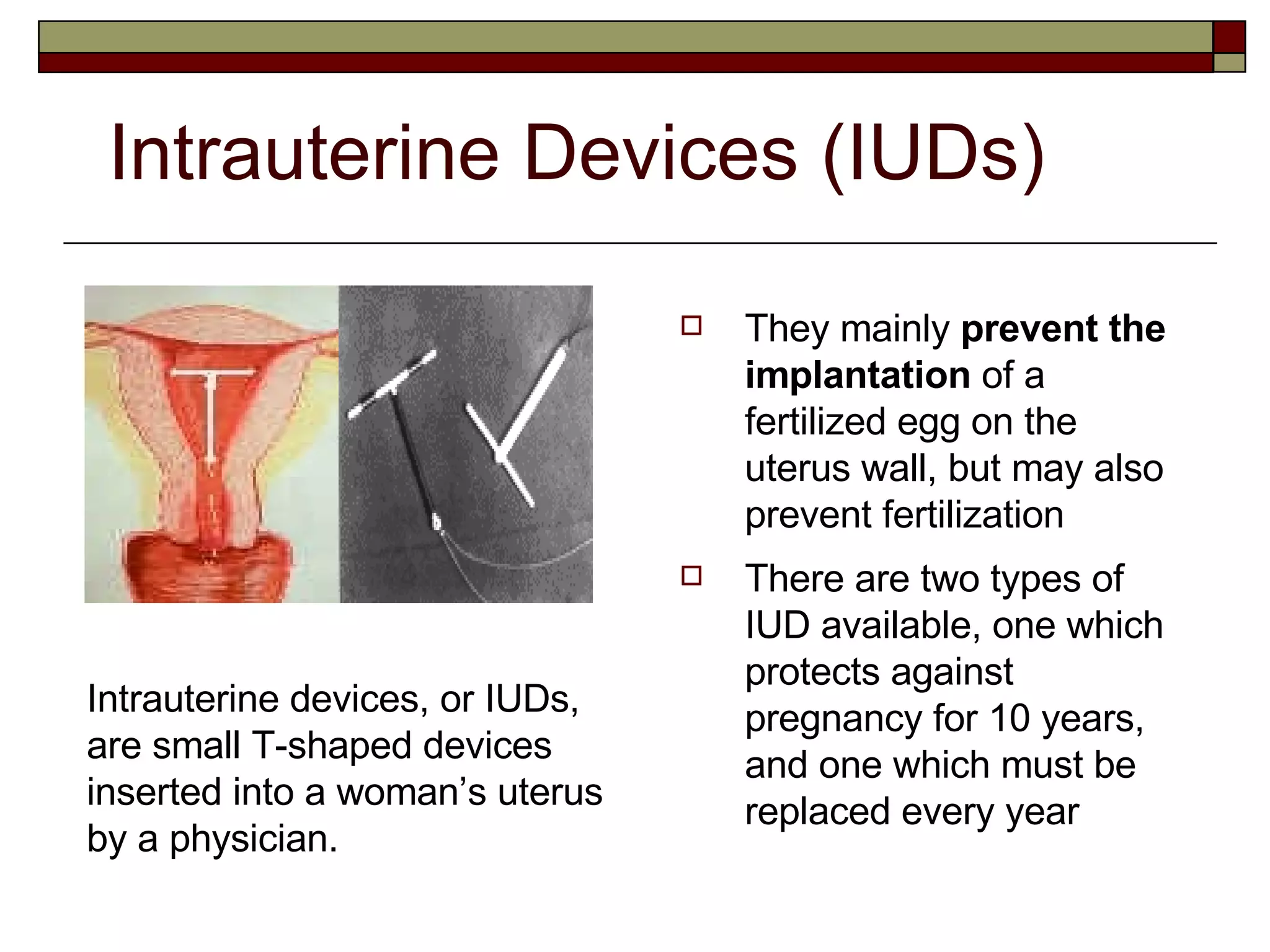 Intrauterine Devices (IUDs) They mainly  prevent the implantation  of a fertilized egg on the uterus wall, but may also prevent fertilization There are two types of IUD available, one which protects against pregnancy for 10 years, and one which must be replaced every year Intrauterine devices, or IUDs, are small T-shaped devices inserted into a woman’s uterus by a physician. 