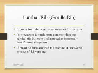 The-Ribs.pptx about the ribs of humen body | PPTX