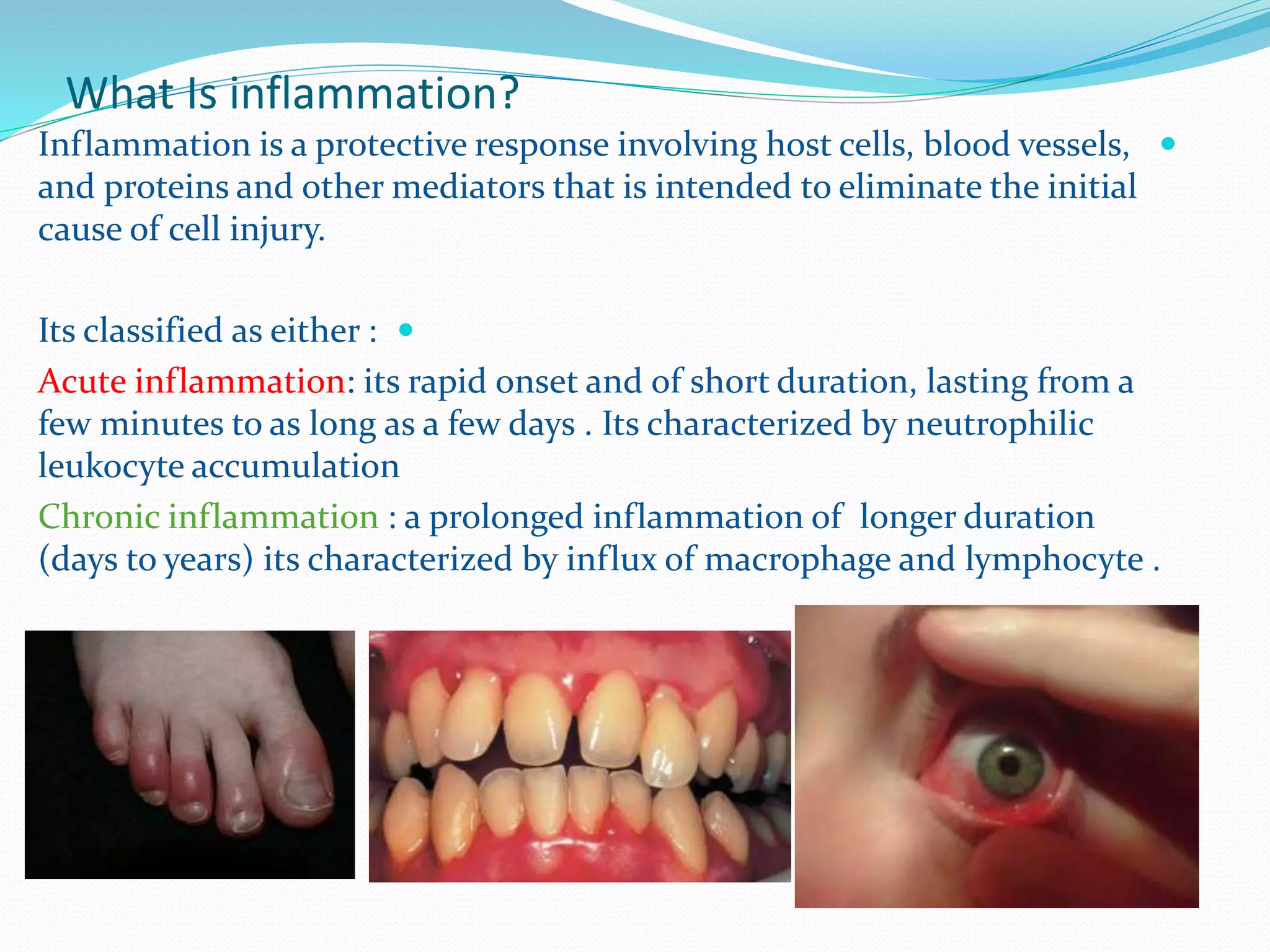 The role of complement system in acute inflamation | PPTX