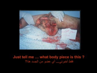 Just tell me … what body piece is this ?  فقط أخبرني ...  أي عضو من الجسد هذا؟ 