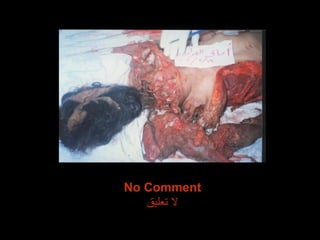 No Comment لا تعليق 