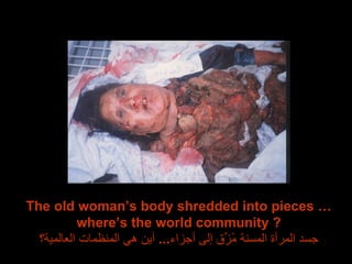The old woman’s body shredded into pieces … where’s the world community ? جسد المرأة المسنة مُزِّق إلى أجزاء ...  أين هي المنظمات العالمية؟ 