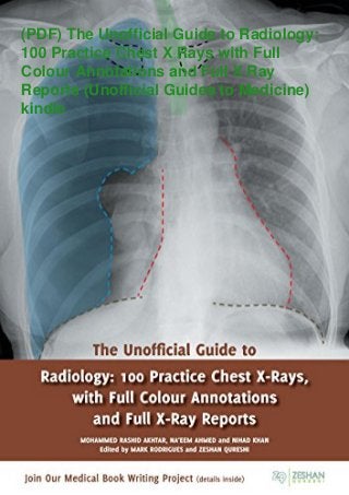(PDF) The Unofficial Guide to Radiology:
100 Practice Chest X Rays with Full
Colour Annotations and Full X Ray
Reports (Unofficial Guides to Medicine)
kindle
 