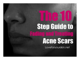 The10
Step Guide to
Fading and Treating
Acne Scars
Loveforyourskin.net
 