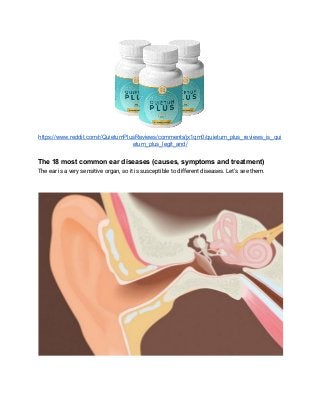 https://www.reddit.com/r/QuietumPlusReviews/comments/jx1qm0/quietum_plus_reviews_is_qui
etum_plus_legit_and/
The 18 most common ear diseases (causes, symptoms and treatment)
The ear is a very sensitive organ, so it is susceptible to different diseases. Let's see them. 
 
 
 
 
 
