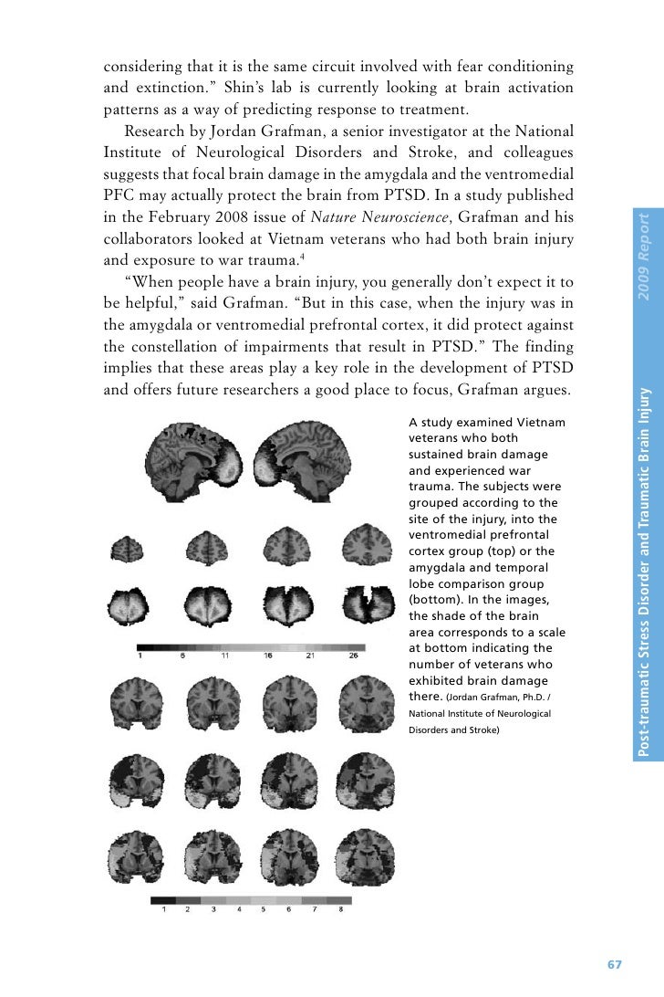 progress in brain research pdf