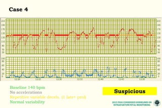 The 2015 FIGO consensus guidelines on intrapartum fetal monitoring ...