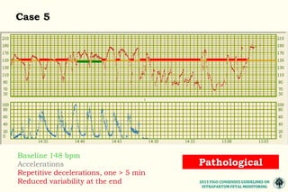 The 2015 FIGO consensus guidelines on intrapartum fetal monitoring ...