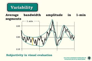 The 2015 FIGO consensus guidelines on intrapartum fetal monitoring ...