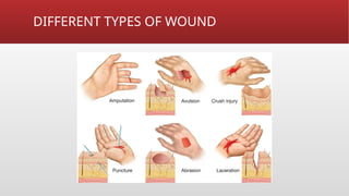 Comprehensive First Aid Basics: Essential Life-Saving Skills and ...
